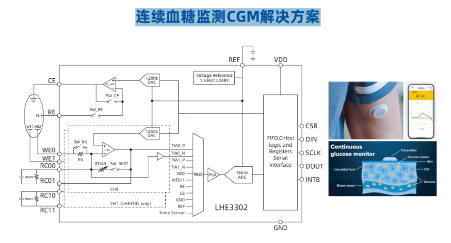 血糖监测应用框图